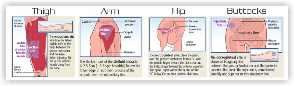 intravenous injection angle