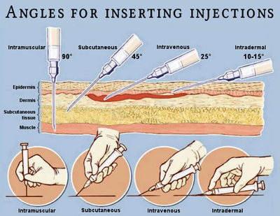 Safer injection guide - PsychonautWiki